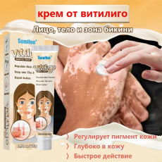 Крем от витилиго против пигментации и белых пятен ,антибактериальный 20гр